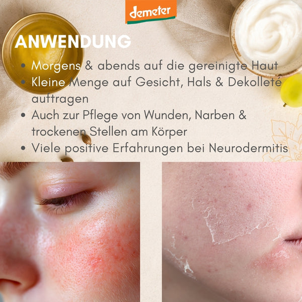 Anwendungs-Infografik mit Hautirritationen und trockenen Hautstellen – Pflege bei Neurodermitis mit dieNikolai Demeter Bio-Traubenkosmetik aus der Wachau