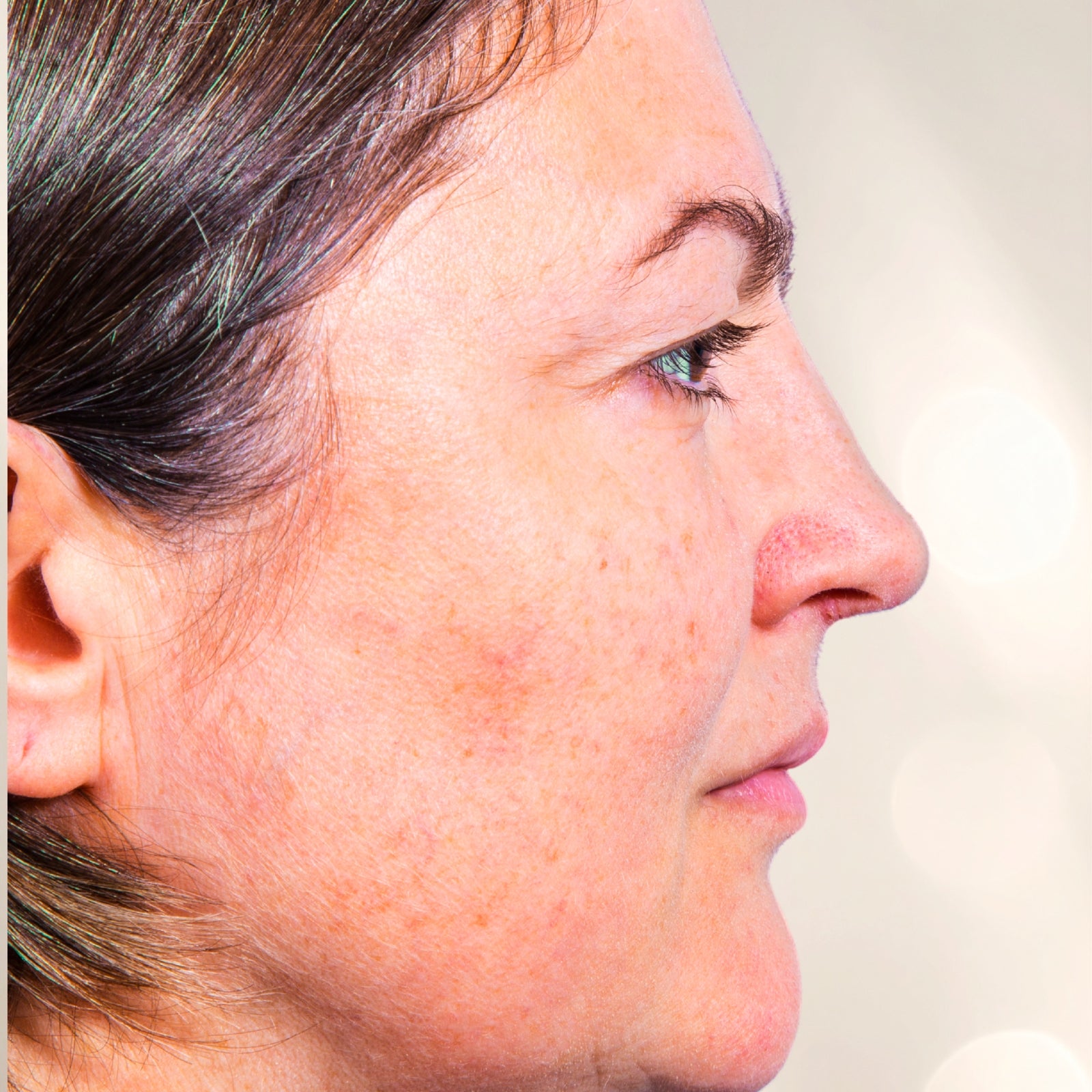 Seitenportrait einer Frau mit sichtbaren Pigmentflecken auf der Wange – Hautbild-Thema für Anti-Aging-Pflege mit dieNikolai Demeter Bio-Traubenkosmetik aus der Wachau